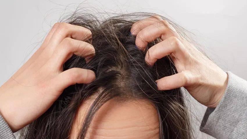 头皮上长红疙瘩脓包头皮屑特别多,头皮和脸上起疙瘩有脓包怎么回事