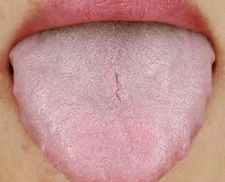 肾虚引起的腰腿酸软经方,自拟补肾壮腰汤治腰痛处方