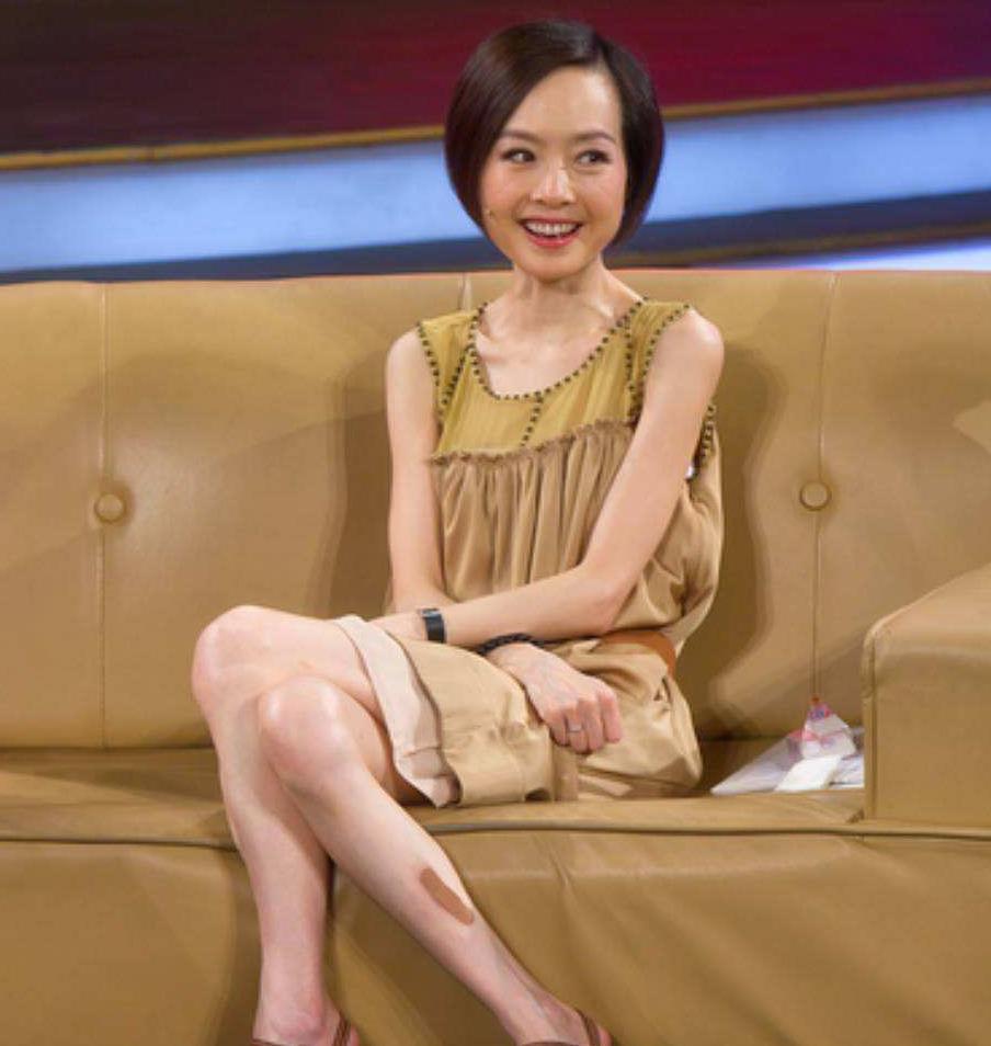 瘦到脸部凹陷到底好不好看,瘦到五官凹陷