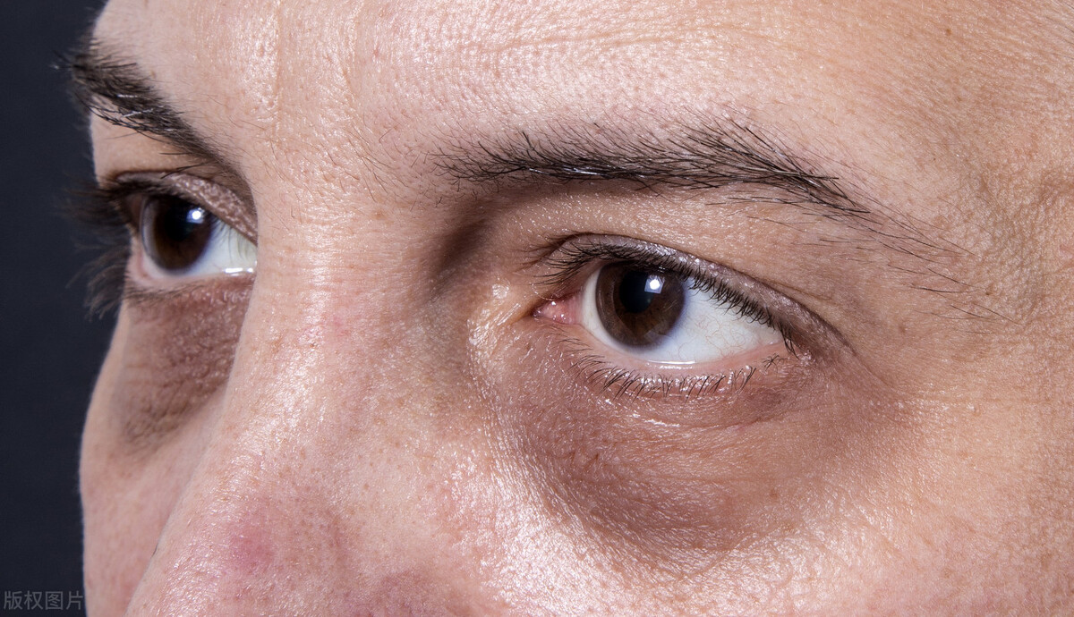 婴儿睡觉哼唧黑眼圈发黑发紫,嘴唇发紫黑眼圈是什么原因引起