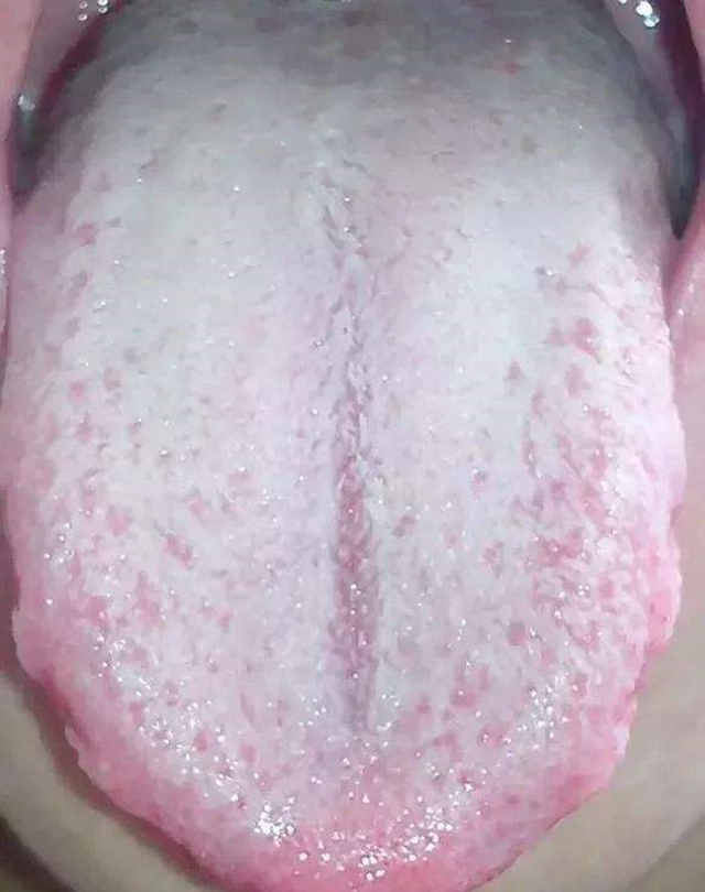 中医认为糖尿病的最好治疗方法,中医治疗糖尿病有几种治疗方案