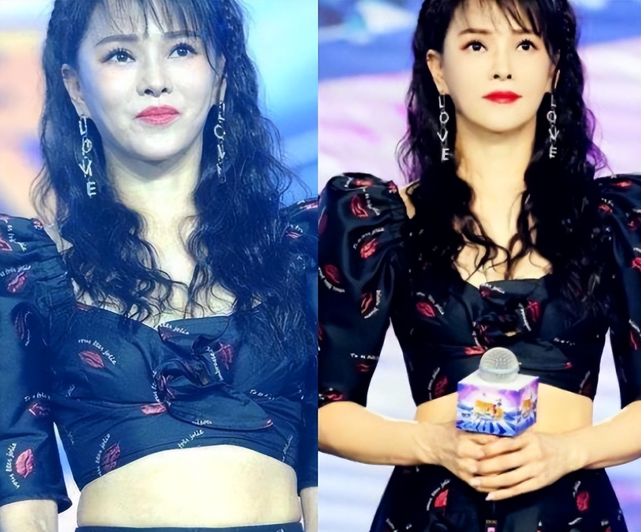 面部衰老皱纹解剖图,面部皱纹衰老对比图