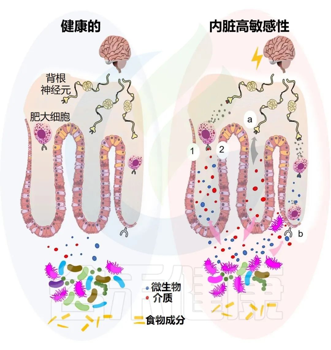 胃胀腹胀腹痛检查均正常,胃胀疼下腹疼喉咙有异物感