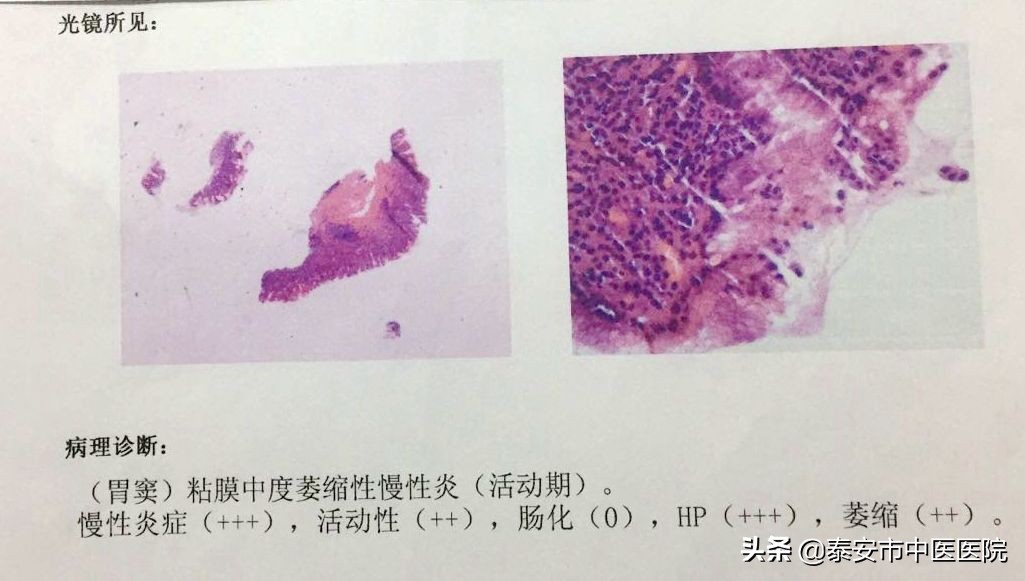 消化内镜微创诊治,消化内镜及消化疾病诊治