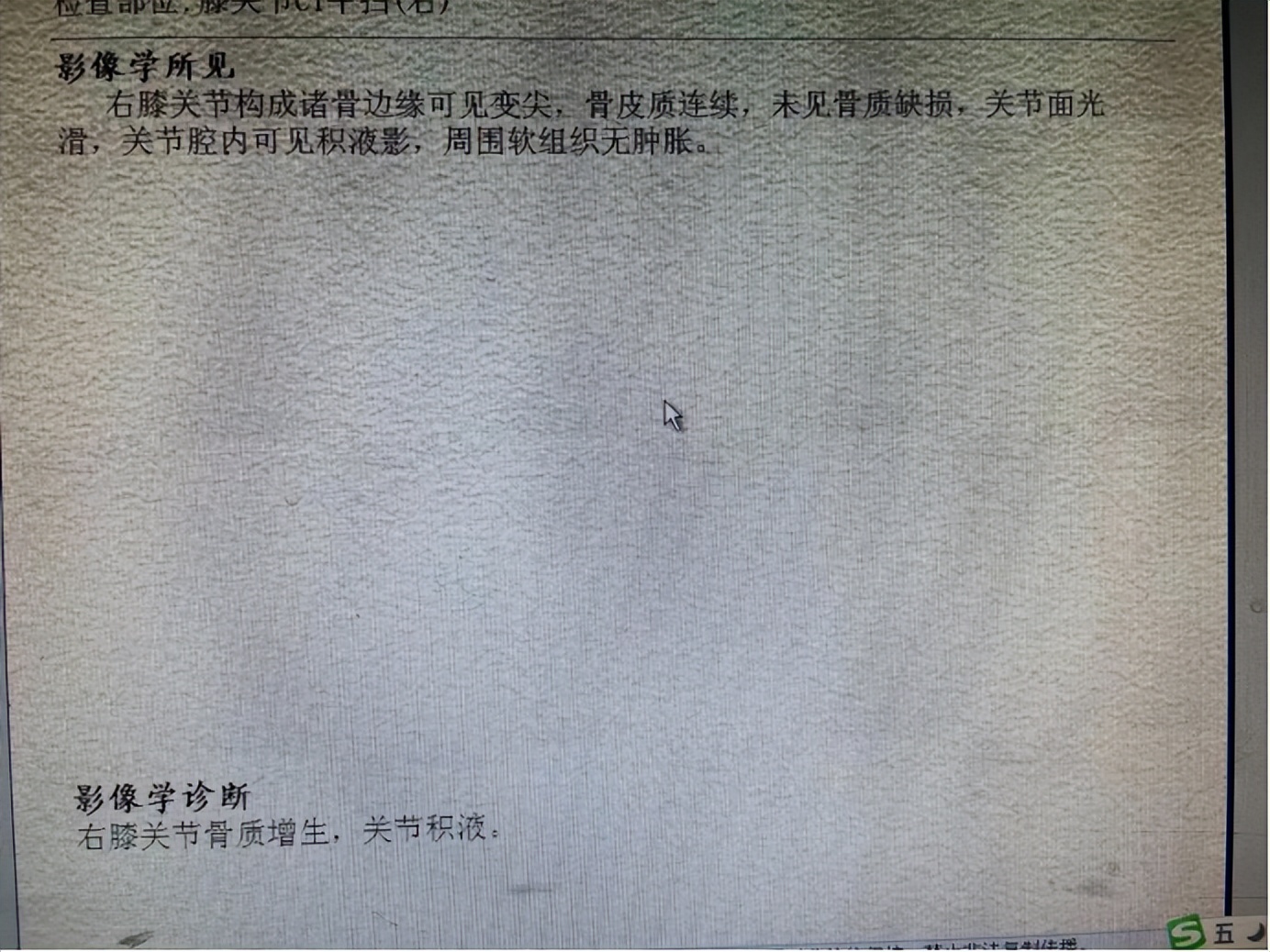 膝关节疼痛：膝关节积液的中医诊治