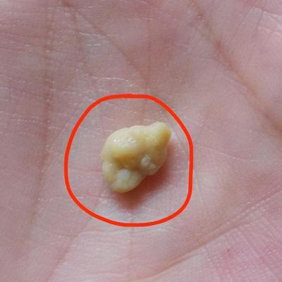 相亲小楠最新视频,小楠的北漂生活最新视频相亲