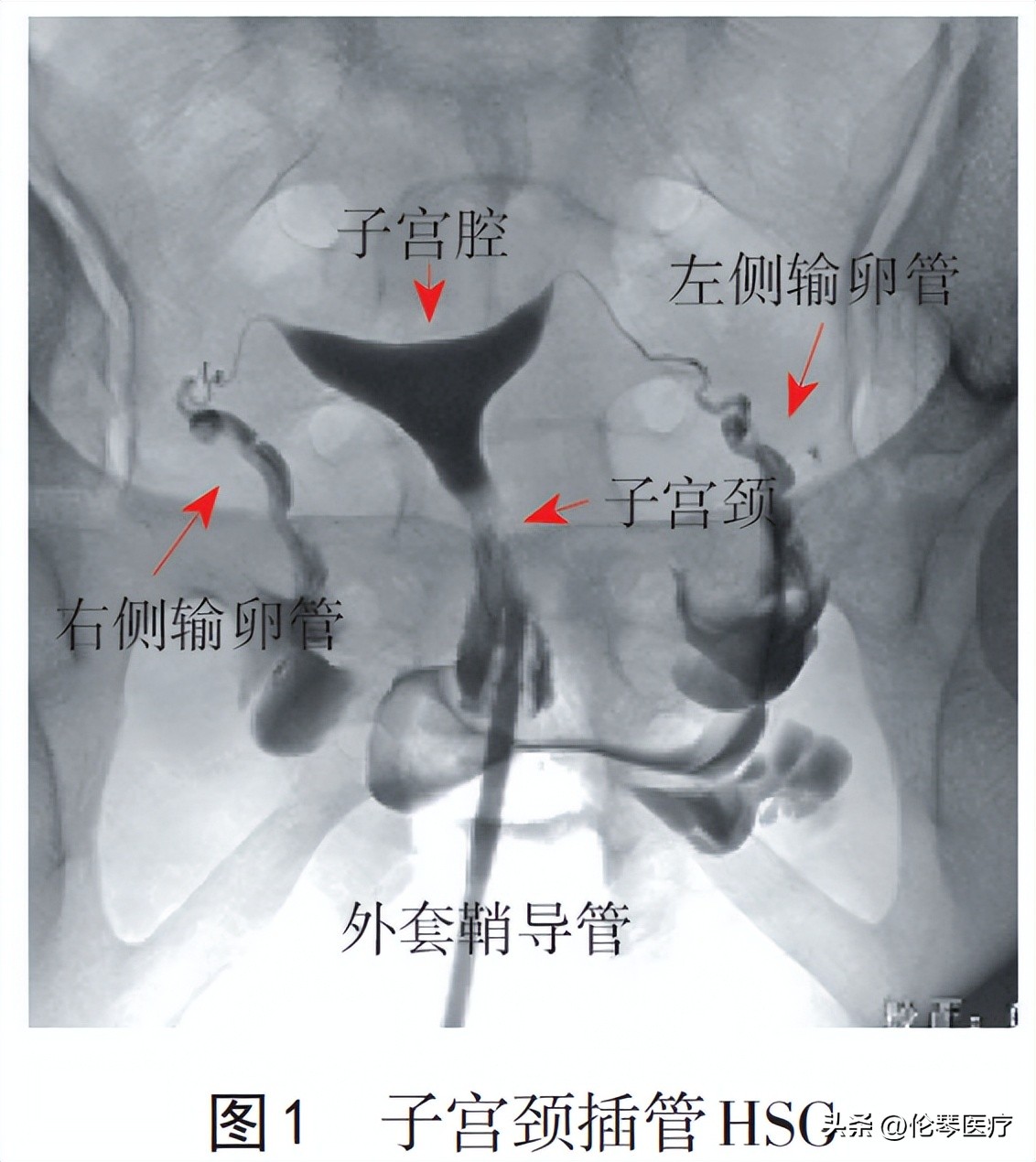 临床指南和专家共识怎么搞免费的,共识指南