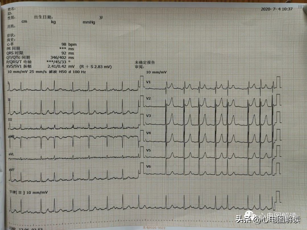 得来不易歌曲视频,得来不易纯音乐