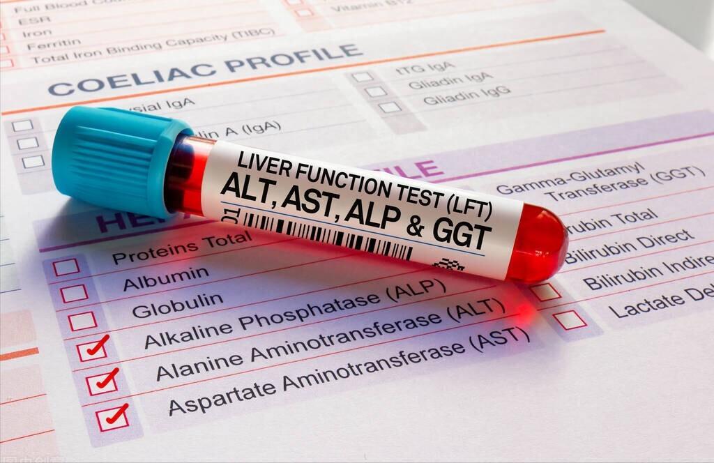 具有利胆保肝作用药物,肝纤维化能吃消炎利胆片吗