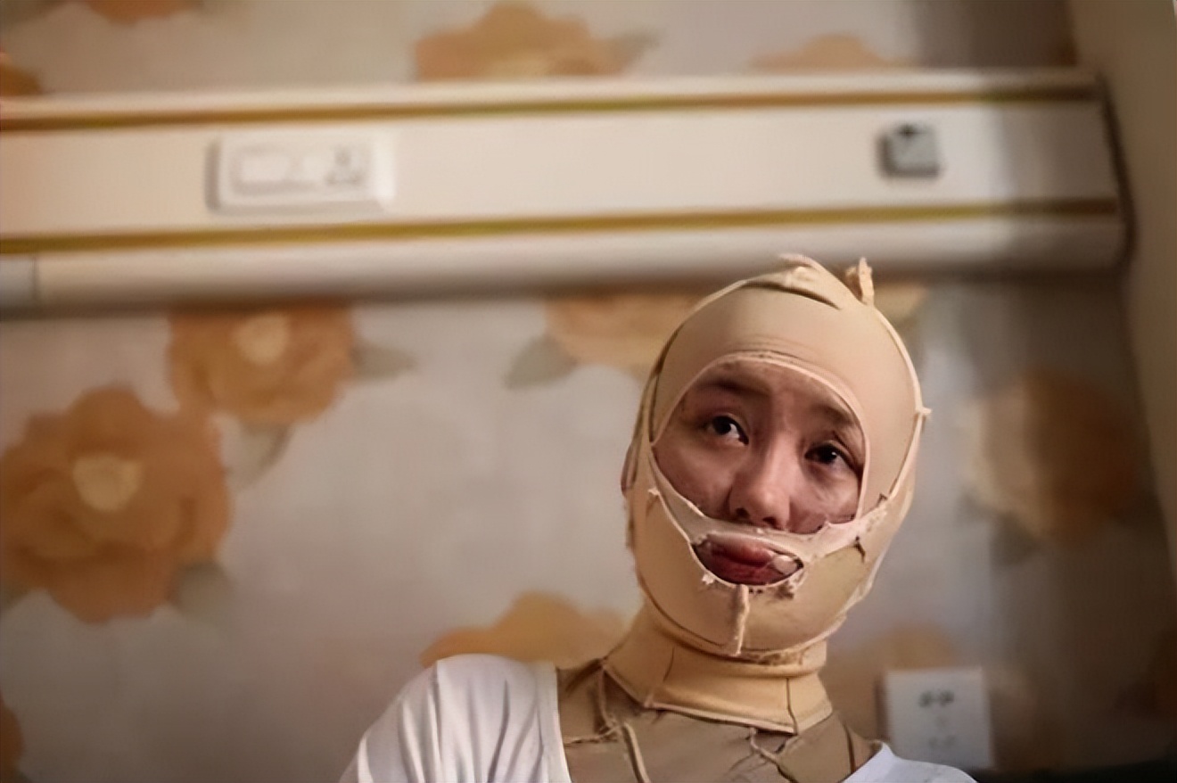 16岁女孩拒绝官二代求爱被毁容,拒绝富二代追求遭毁容以前照片