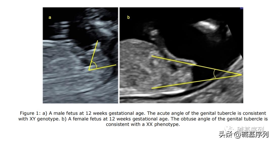 怀孕了第一胎宝宝会知道么,怀孕胎儿外貌什么时候确定