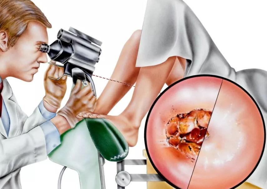 女生首次出血多久可以愈合,女生首次出血多久能愈合