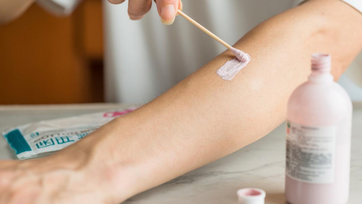 腿上出好多小丘疹是hpv感染吗,腿上痒成片起红疹是感染hpv吗