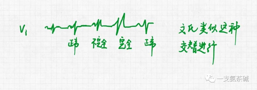 心电图临界异常右束支传导阻滞,心电图十二导和十八导
