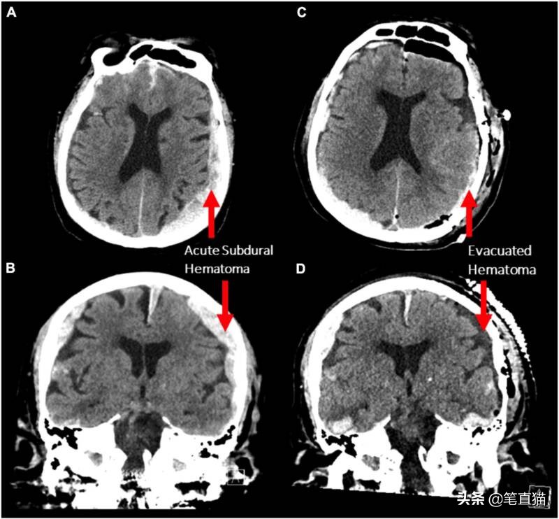 医学家揭秘人在死亡瞬间的感觉,科学证明人类死了要去哪里