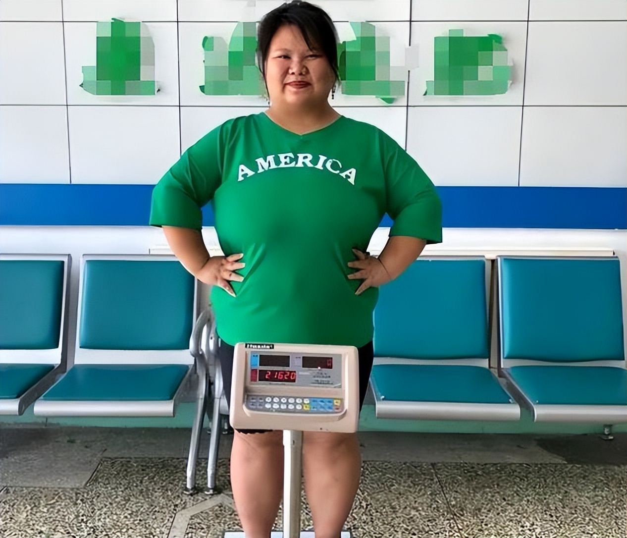 当年校花被丈夫养胖三百多斤,结婚3年校花被丈夫喂胖到332斤