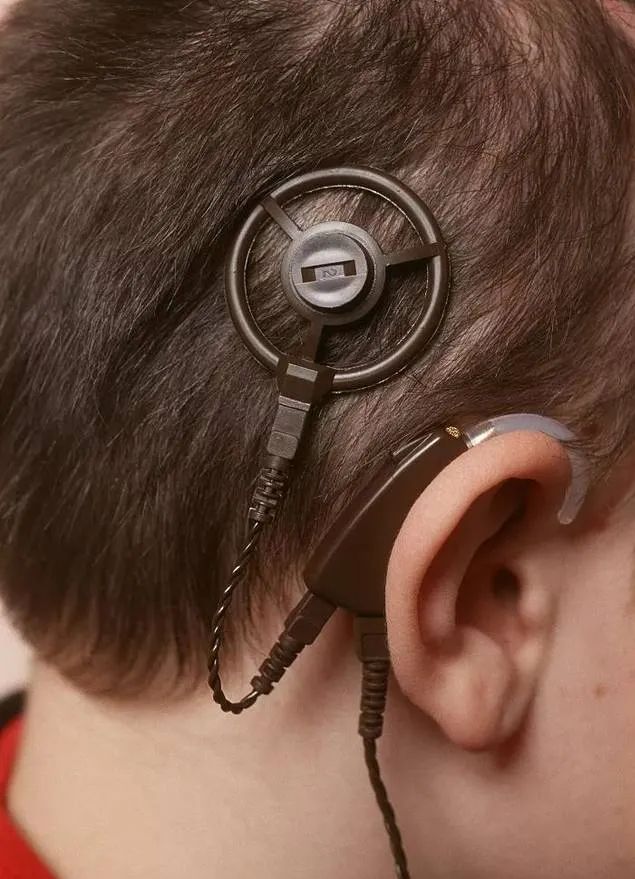 人工耳蜗开机后要注意什么,人工耳蜗开机要注意什么