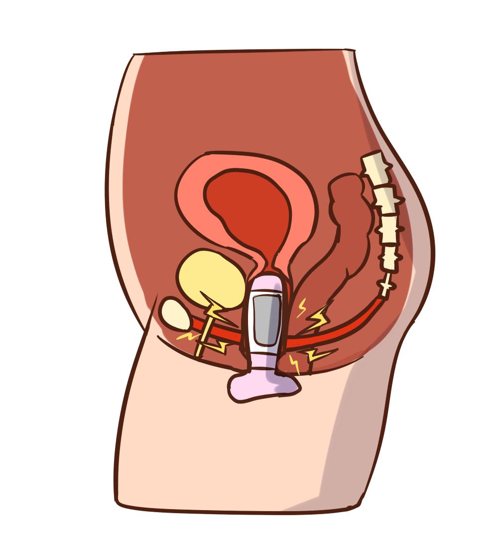 啪啪时女生阴道发出“噗噗”的声音，咋回事？医生：这是一种疾病