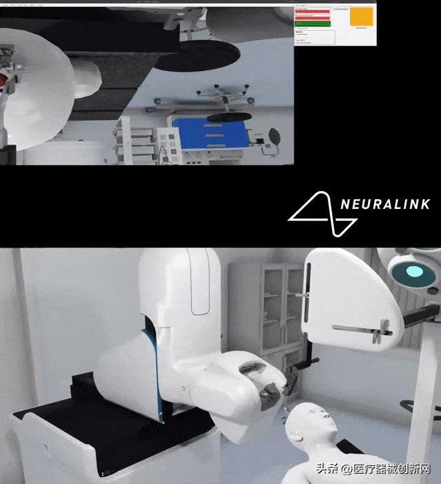 马斯克脑机接口临床试验是真的吗,fda马斯克脑机接口