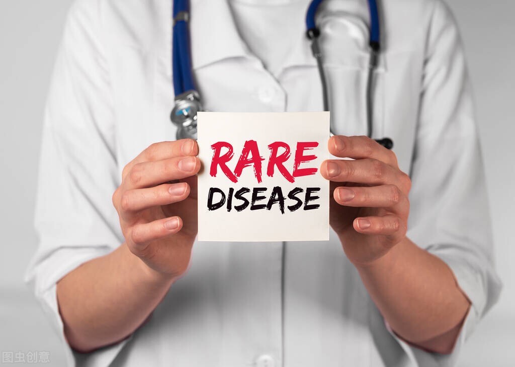 肢端肥大症遗传吗,肢端肥大症的结局