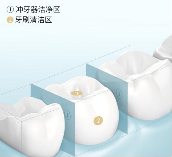 水牙线冲牙器洁牙家用第一名,水牙线冲牙器哪个牌子好