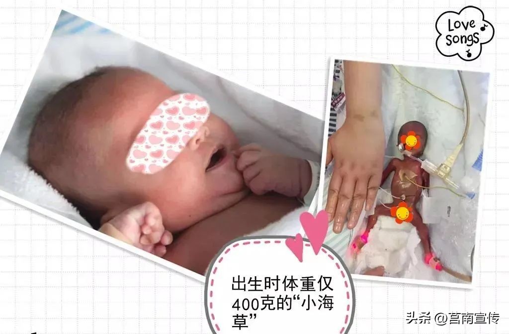 早产儿体重2斤能存活吗,不到两斤的早产儿能存活吗