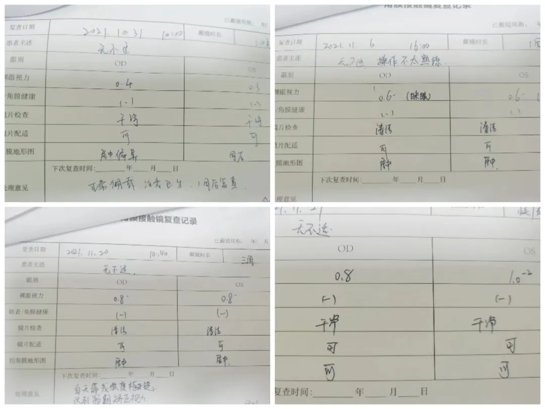 南阳南石眼科医院角膜塑形镜,南阳硬性角膜塑形镜