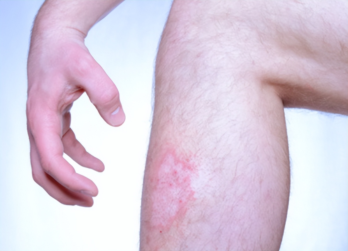 比疫情更可怕的危机来了，很多人却浑然不知，建议老百姓做好预防