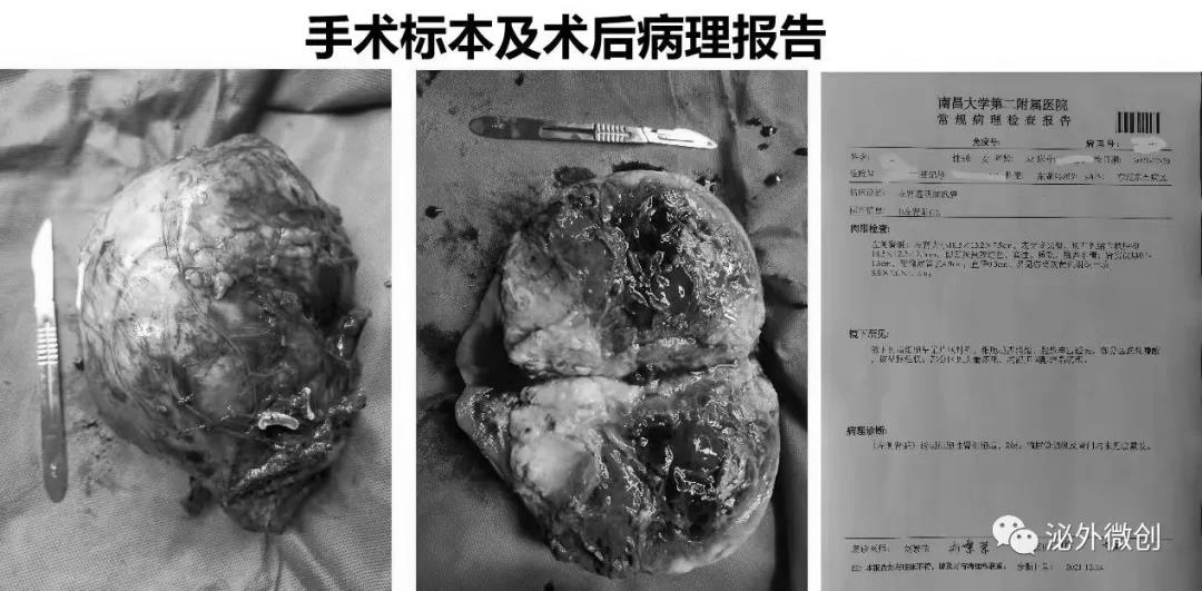 南昌大学二附院胡红林,南昌大学第二附属医院胡红林