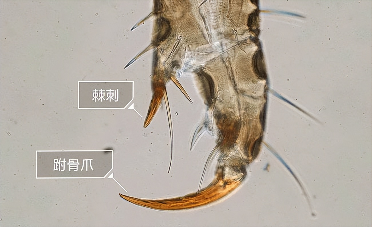 孩子眼睛长阴虱怎么处理,阴虱长在小孩眼睫毛上