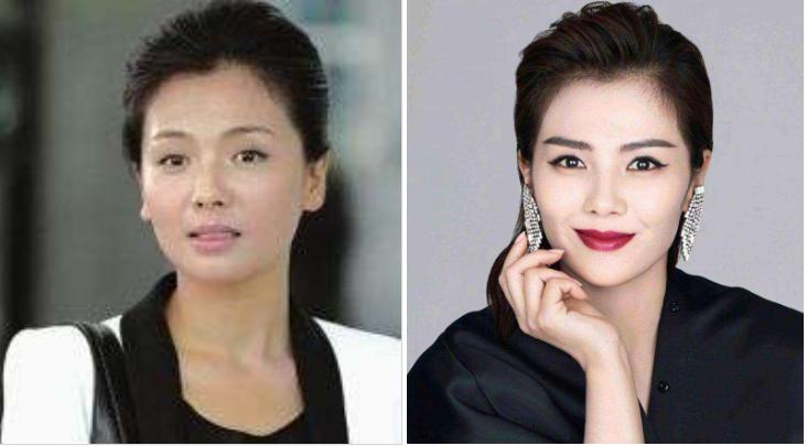 有颧骨的人怎么会显的好看,高颧骨是显老还是显年轻