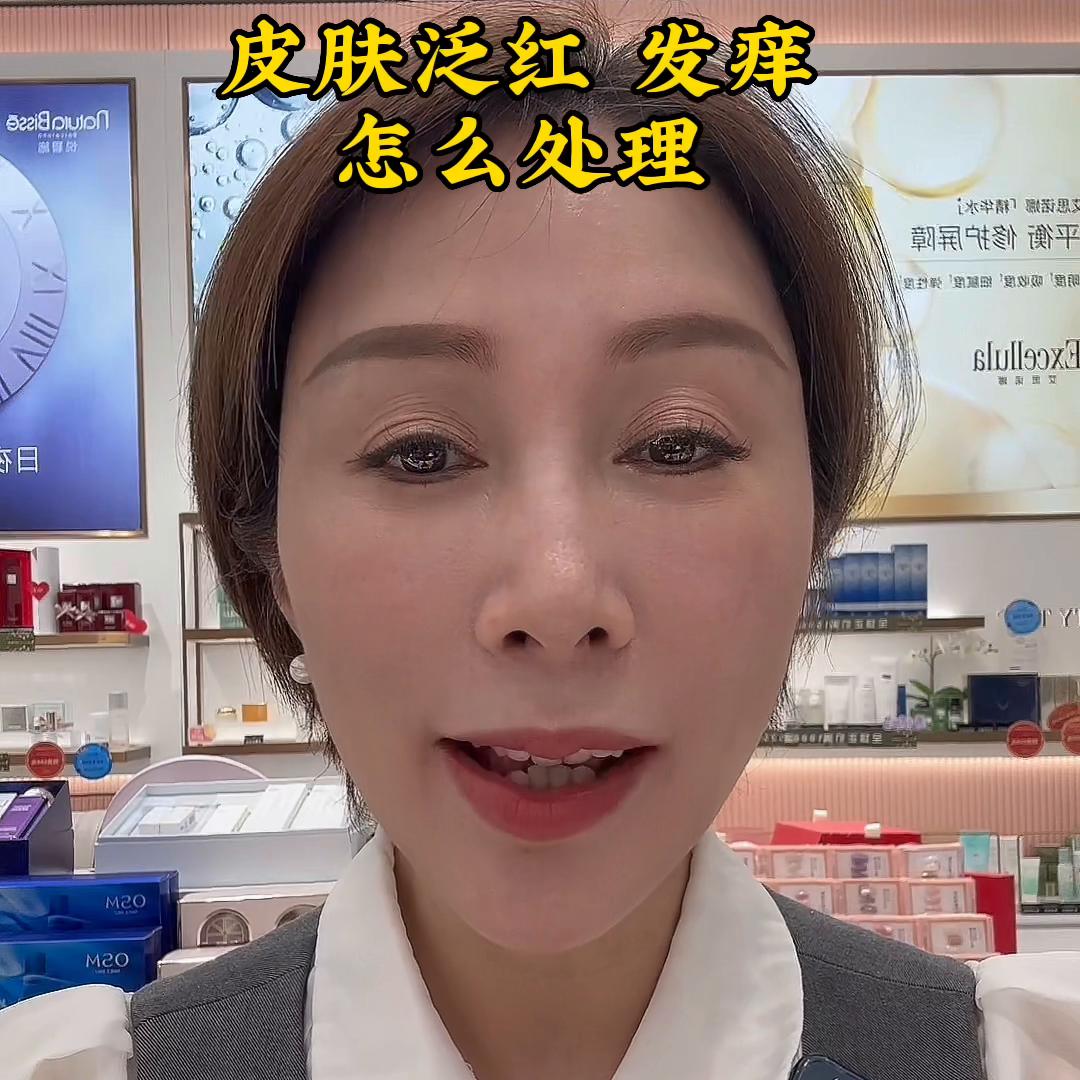 皮肤泛红发痒怎么办,儿童春季皮肤过敏泛红发痒小妙招