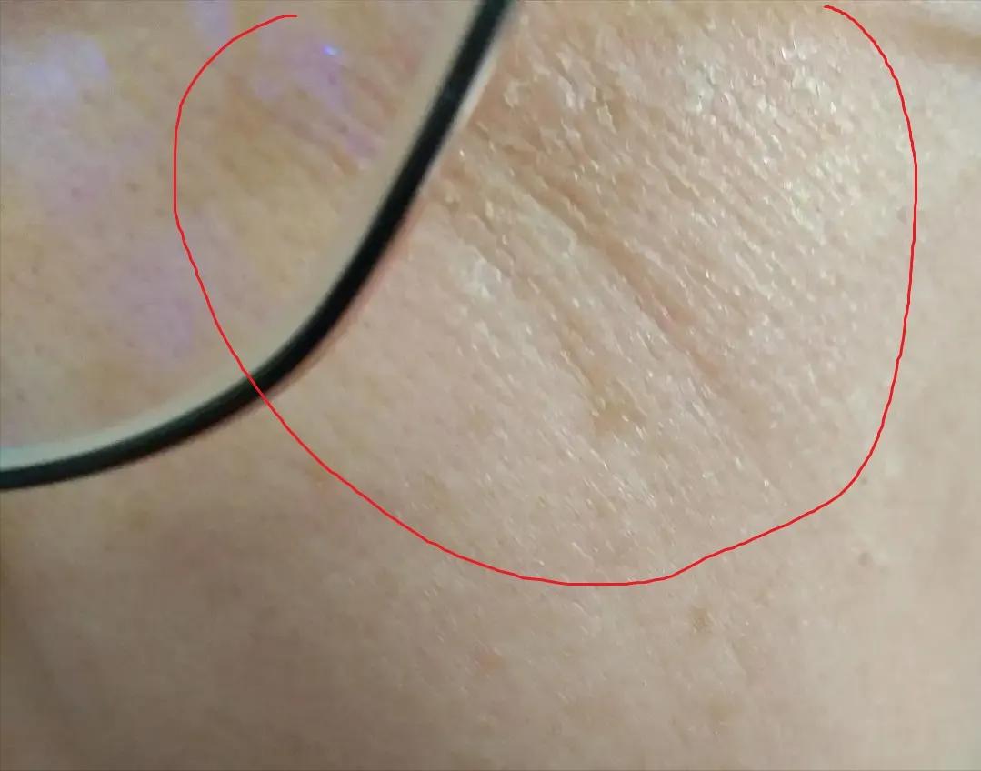 为什么用完洗面奶脸部泛红起皮,为什么用完洗面奶后脸更黑了