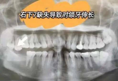 国民初恋毁容了,国民初恋盛世美颜