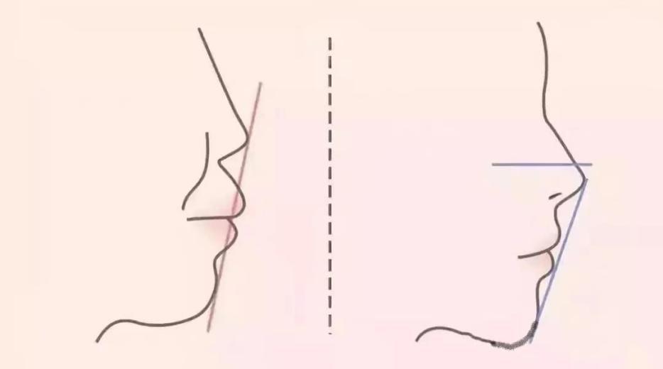 三招自测嘴突,判断嘴突