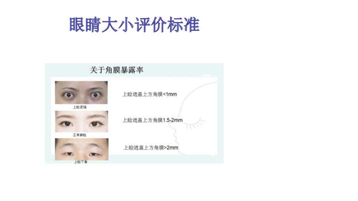 大小眼怎么改善,大小眼严重美睫能改善吗