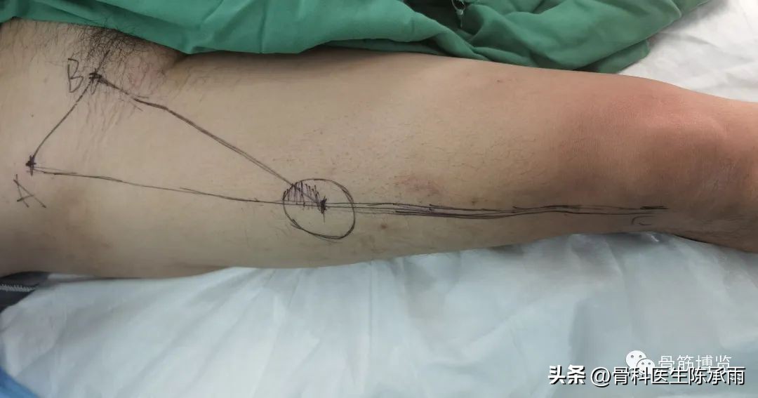 娓哥鐨摚淇,涔旀皬鐨摚淇瓒宠儗澶栦晶鐨偆缂烘崯