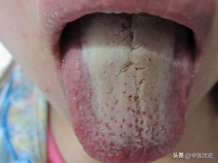 治脾不治肝,养肝疏肝调理脾胃的中成药