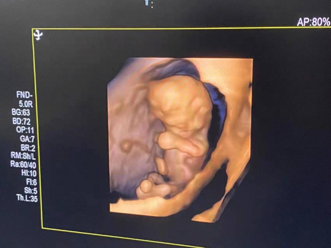 牟方祥在哪个医院,牟方祥医生去哪里了