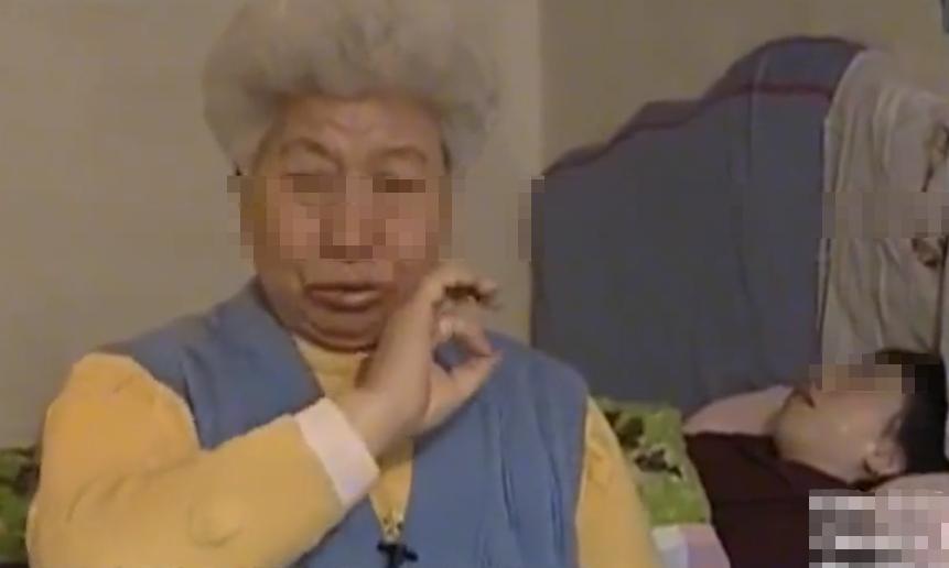 故事：大连39岁姑娘患怪病，皮肤坚硬宛如石膏，专家结论希望渺茫