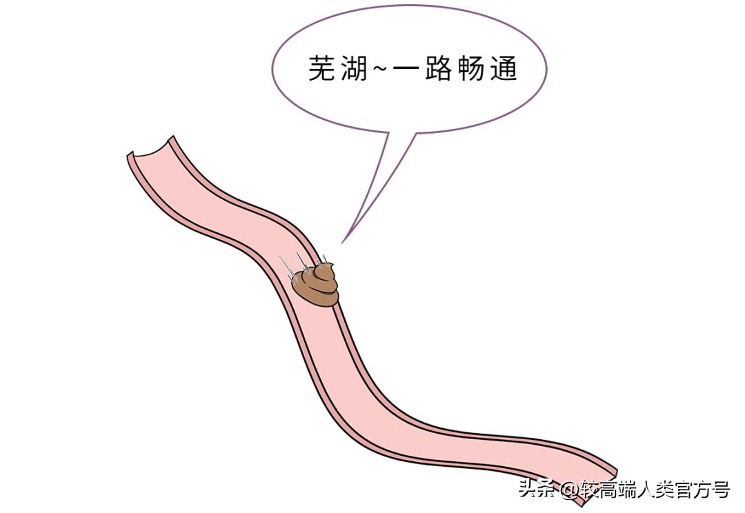 手术过后大便忍不住拉不出来,手术中想拉屎怎么办