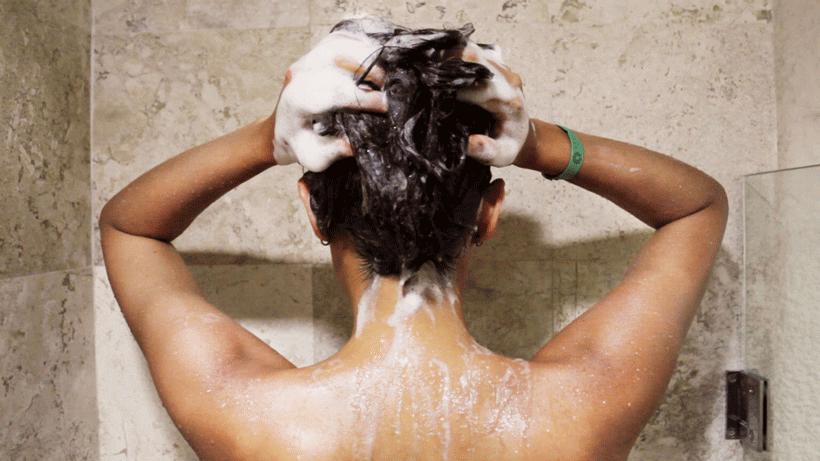 头屑多可能是脱发前兆,皮肤科医生头皮痒头屑多怎么解决