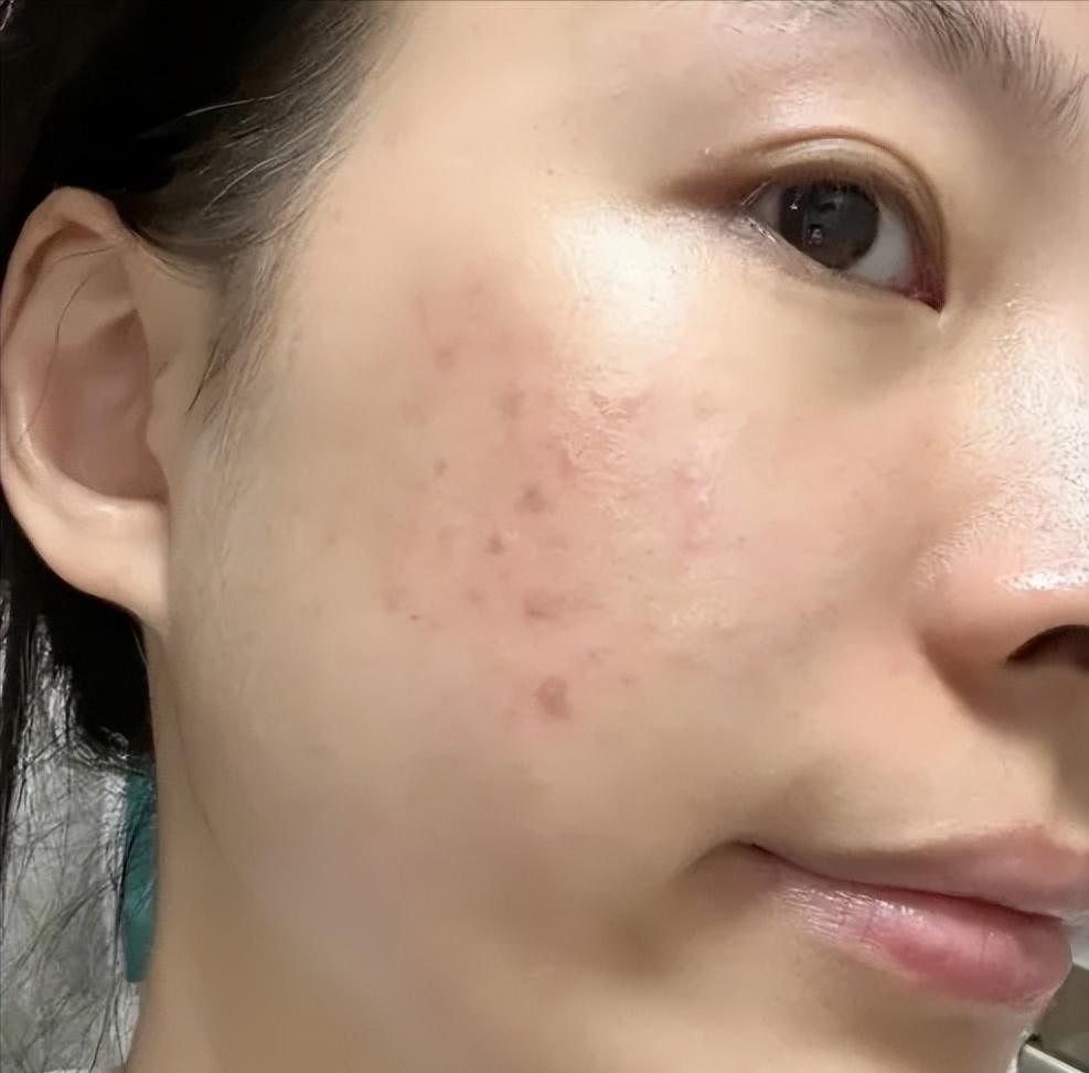 口碑好的抗衰老护肤品,口碑最好的抗衰老护肤品有哪些