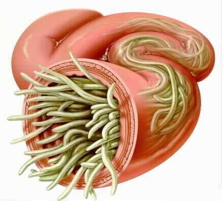 为什么90年代有蛔虫现在却没有了,以前为何有蛔虫