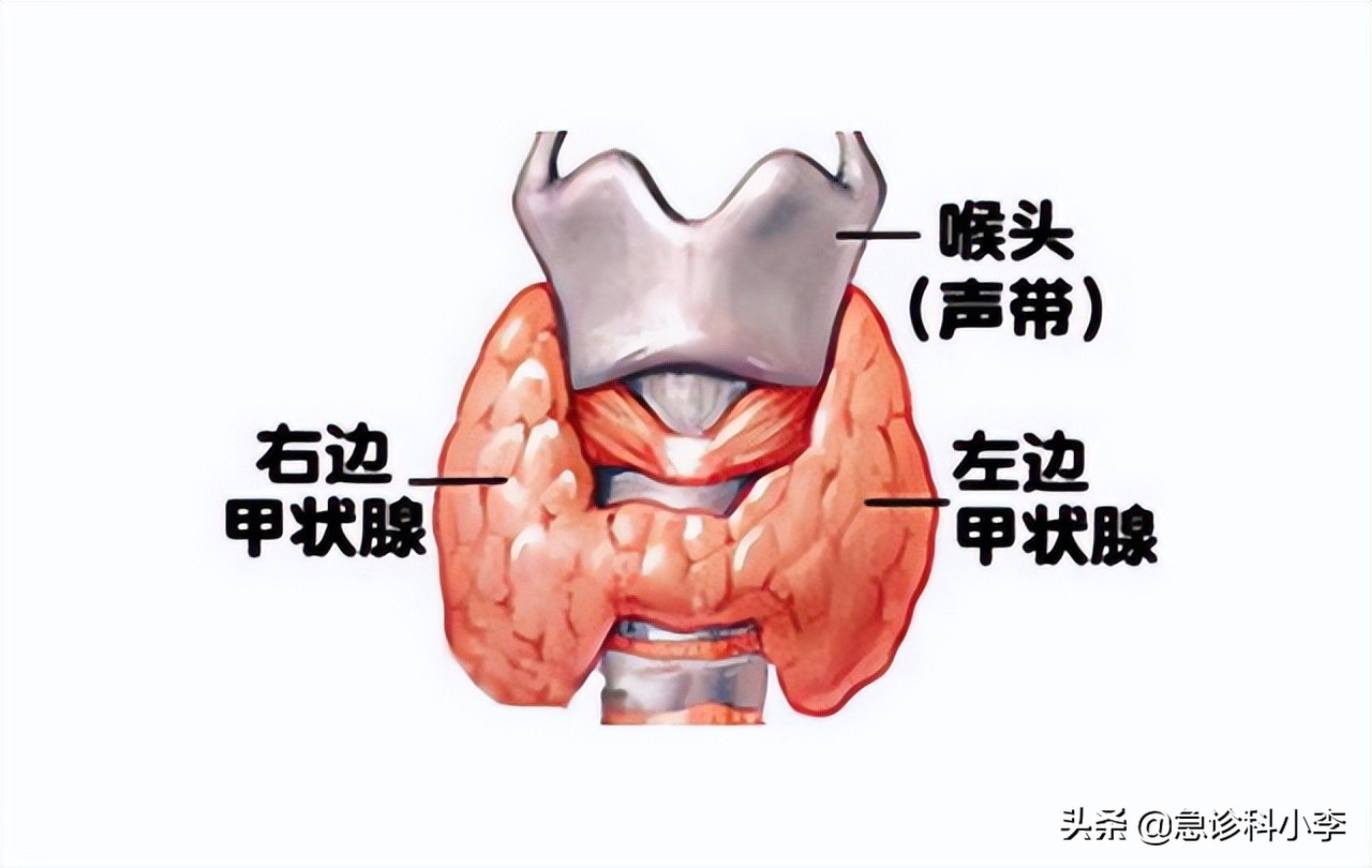 甲状腺结节伴有甲亢最好治疗方法,检查出甲状腺结节怎么办