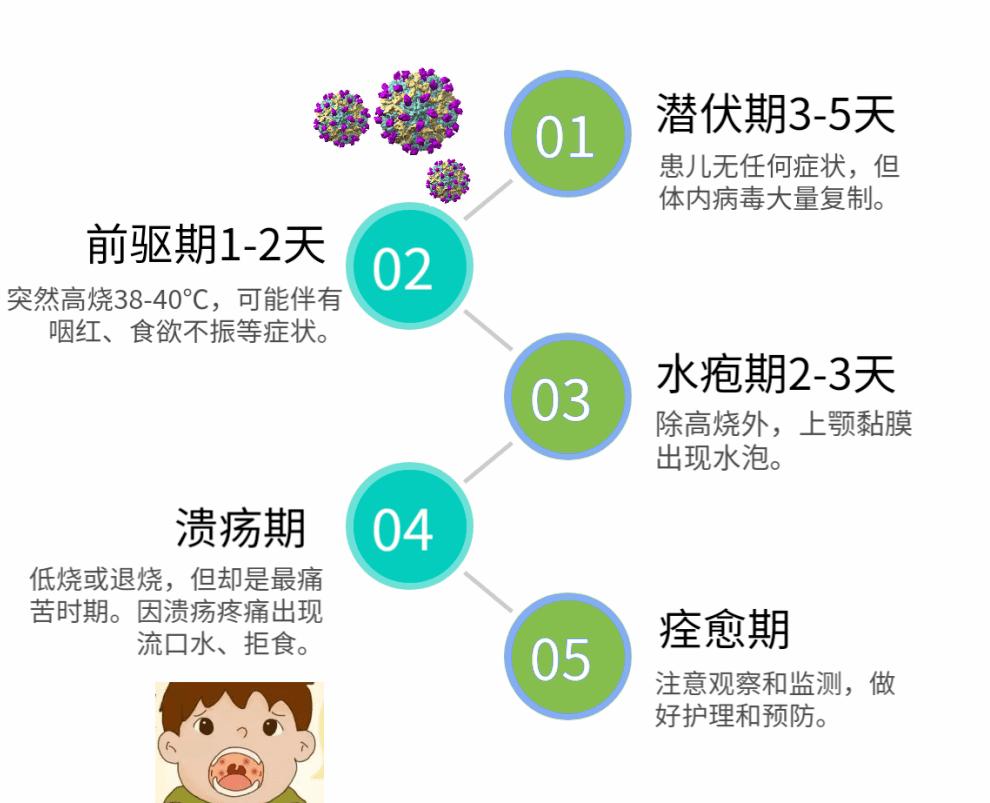 双黄连口服液佐治疱疹性咽峡炎的临床观察