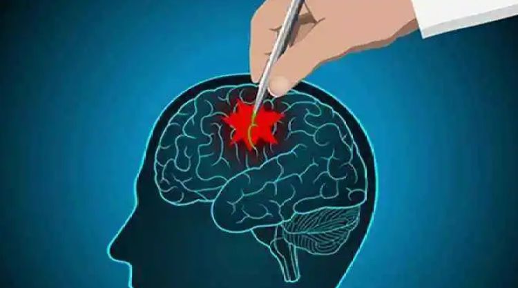 长宁医生提醒：这种疾病发作时，不可掐人中、撬嘴巴