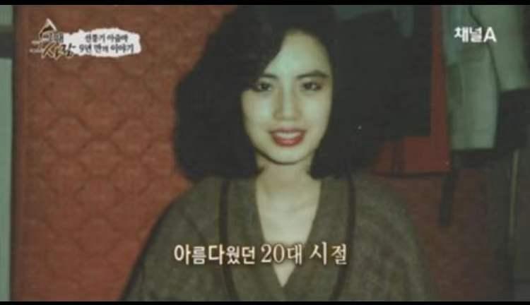 韩慧景整容是打了玻尿酸了吗,韩慧景整容案例