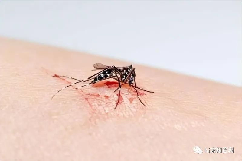 蚊子驱蚊黑科技,驱蚊子最有效的黑科技