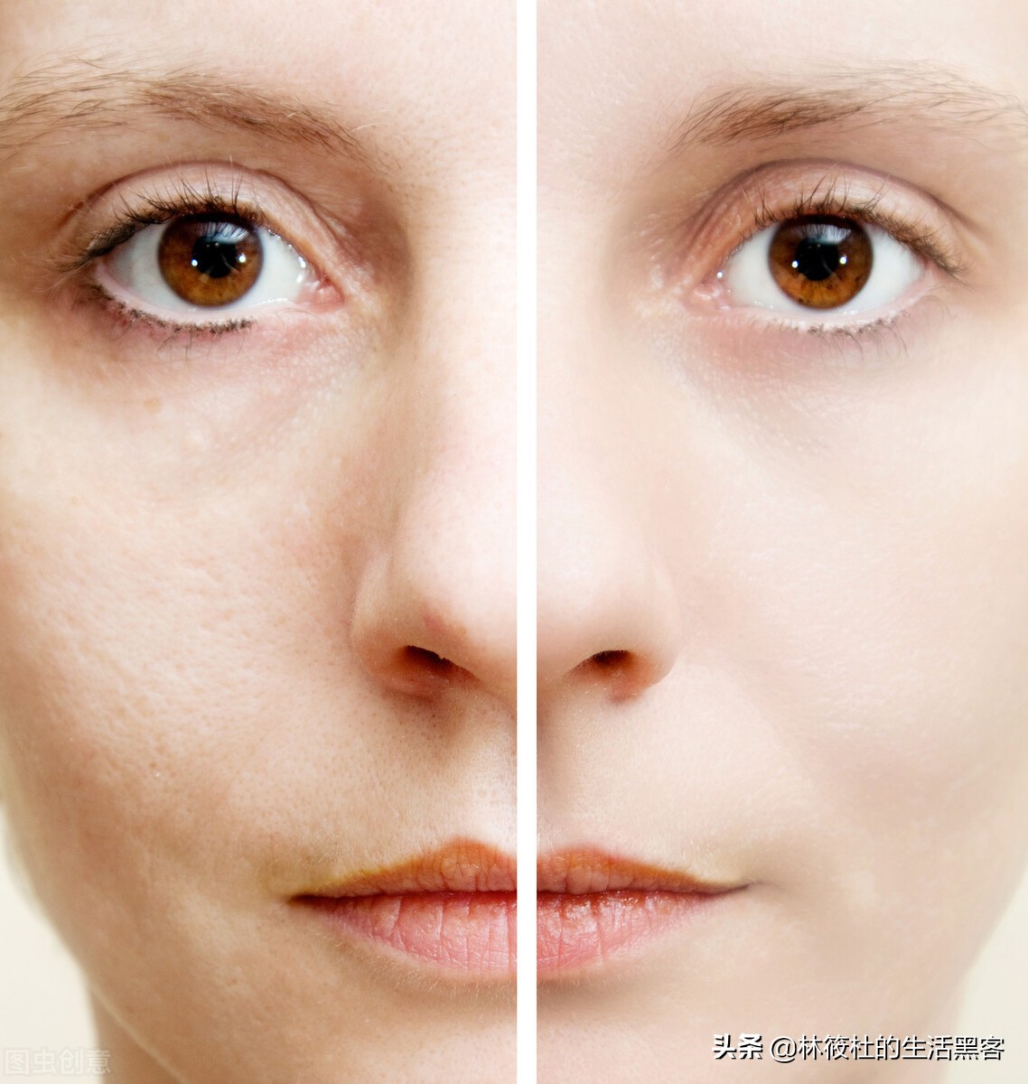 如何收缩脸部粗大毛孔,脸部毛孔粗大最好的解决修复方法